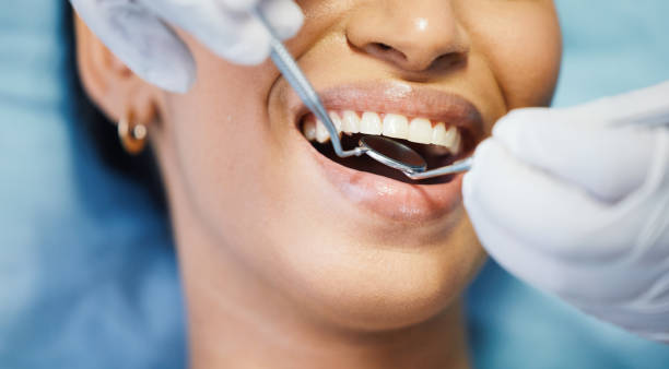 Best Emergency Broken Tooth Repair in Nedrow, NY